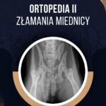 ORTOPEDIA II – ZŁAMANIA MIEDNICY