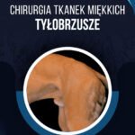 CHIRURGIA TYŁOBRZUSZA