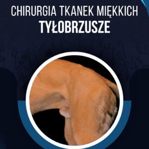 CHIRURGIA TYŁOBRZUSZA