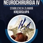 STABILIZACJA ZŁAMAŃ KRĘGOSŁUPA