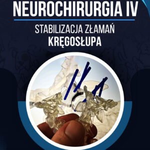 STABILIZACJA ZŁAMAŃ KRĘGOSŁUPA