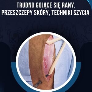 TRUDNO GOJĄCE SIĘ RANY, PRZESZCZEPY SKÓRY, TECHNIKI SZYCIA
