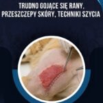 TRUDNO GOJĄCE SIĘ RANY, PRZESZCZEPY SKÓRY, TECHNIKI SZYCIA