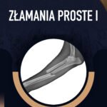 ZŁAMANIA PROSTE I