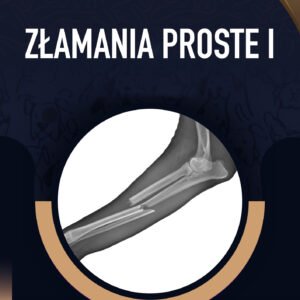 Złamania proste I
