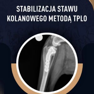 Stabilizacja stawu kolanowego metodą TPLO
