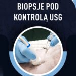 BIOPSJE POD KONTROLĄ USG