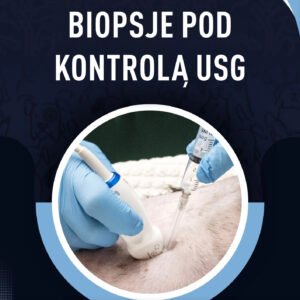 BIOPSJE POD KONTROLĄ USG