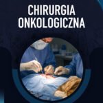Chirurgia onkologiczna