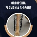 ORTOPEDIA ZŁAMANIA ZŁOŻONE
